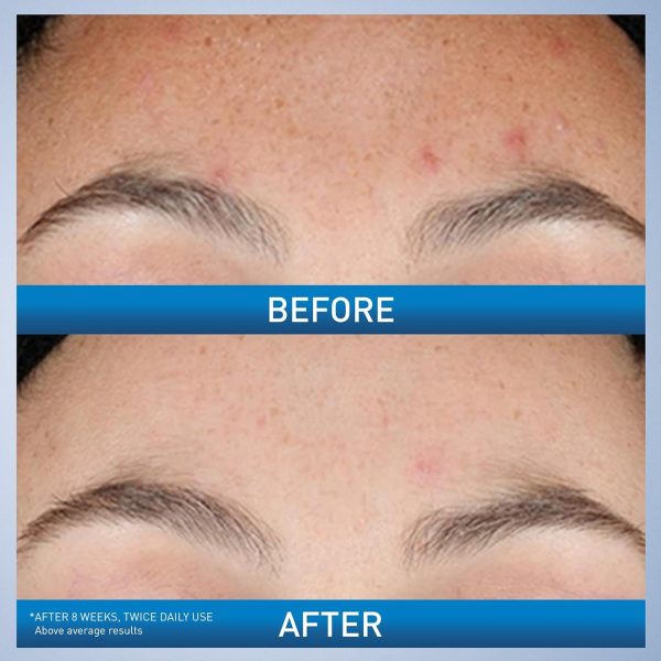 CeraVe Resurfacing Retinol Serum - 30ml