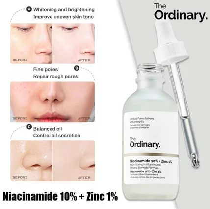 Niacinamide 10% + Zinc 1% Serum - 30ml